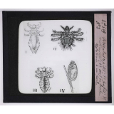 Maladies de la peau causées par des parasites. 2e série: insectes et champignons. 1° Pediculus capitis; 2° pediculus pubis; 3° pediculus vestimenti; 4° oeuf ou lente agglutinée à un poil.