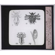 Maladies de la peau causées par des parasites. 2e série: insectes et champignons. 1° Pediculus capitis; 2° pediculus pubis; 3° pediculus vestimenti; 4° oeuf ou lente agglutinée à un poil.