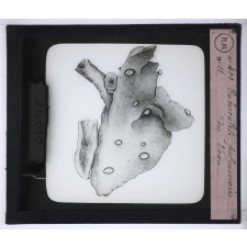 La Tuberculose bovine et les moyens de la combattre. Tuberculose pulmonaire du veau.