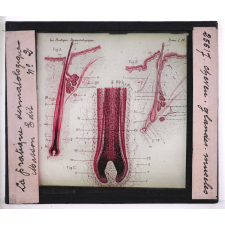 Les Maladies du cuir chevelu. Cheveu, glandes, muscles.