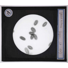 Digestion et circulation. Globule de sang de pigeon.