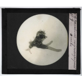 Quelques exemples d'observations microscopiques. Amibe.