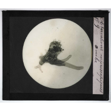 Quelques exemples d'observations microscopiques. Amibe.