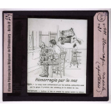 Soins d'urgence aux blessés et malades. Hémorragie nasale (épistaxis).