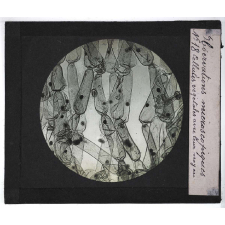 Quelques exemples d'observations microscopiques. Cellules végétales avec leur noyau.