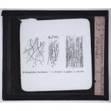 Le Microscope. Ce qu'il permet de voir dans le corps humain. Champignon trichophyton (teigne).