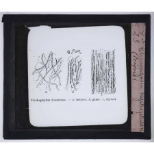 Le Microscope. Ce qu'il permet de voir dans le corps humain. Champignon trichophyton (teigne).