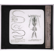Les Animaux parasites de l'homme. Filaria medinensis.