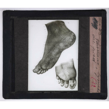 Circulation du sang. Vaisseaux lymphatiques du pied.