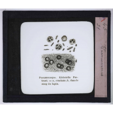 Le Microscope. Ce qu'il permet de voir dans le corps humain. Pneumococcus.