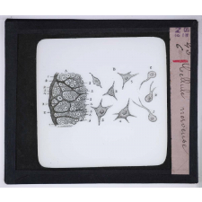Le Microscope. Ce qu'il permet de voir dans le corps humain. Cellule nerveuse.