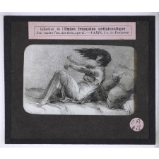 Vues anti-alcooliques. Épilepsie absinthique chez une femme.