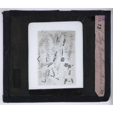 Pasteur. La tuberculose.