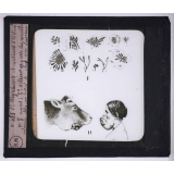 Maladies transmises à l'homme par les animaux. 1° Mycélium et massues d'Actinomyces - 2° actinomycose du maxillaire inférieur chez un boeuf et chez une femme.