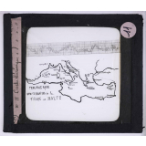 Maladies transmises à l'homme par les animaux. Carte des foyers de la fièvre de Malte - courbe thermique de la fièvre de Malte. 