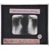 La Radiographie appliquée aux Sciences médicales. Anévrisme de l'aorte - Camelot Poinsignon catalepsie.