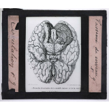 Circulation du sang. Vaisseaux du cerveau.