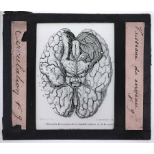 Circulation du sang. Vaisseaux du cerveau.