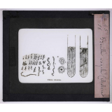 Microbes bacilles. Bacille virgule (choléra).
