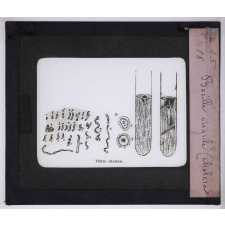 Microbes bacilles. Bacille virgule (choléra).