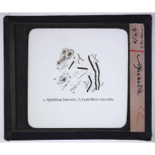 Le Microscope. Ce qu'il permet de voir dans le corps humain. Spirille.