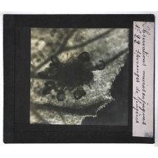 Quelques exemples d'observations microscopiques. Sporanges de fougères.