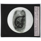 Quelques exemples d'observations microscopiques. Infusoire cilié (cursaria).