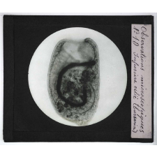 Quelques exemples d'observations microscopiques. Infusoire cilié (cursaria).