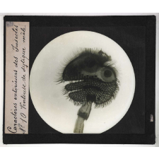 Caractères extérieurs des insectes. Ventouse de dytique mâle.