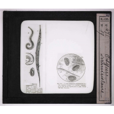 Les Animaux parasites de l'homme. Oxyure vermiculaire.
