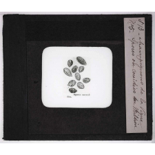 Les Maladies cryptogamiques de la vigne. Spores ou conidies du mildiou.