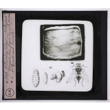 Maladies de la peau causées par des parasites. 2e série: insectes et champignons. 1° Creeping disease; 2° larves d'hypoderma lineata fixées dans la peau; 3° hypoderma lineata.