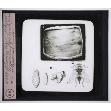 Maladies de la peau causées par des parasites. 2e série: insectes et champignons. 1° Creeping disease; 2° larves d'hypoderma lineata fixées dans la peau; 3° hypoderma lineata.