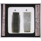 Les Maladies du cuir chevelu. Cheveux de teigne tondante à petites spores.