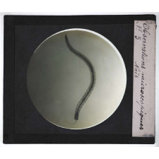 Quelques exemples d'observations microscopiques. Naïs.