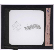 Microbes bacilles. Épithélium vibratile - Épithélium cylindrique.