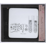 Le Microscope. Ce qu'il permet de voir dans le corps humain. Bacille virgule (choléra).