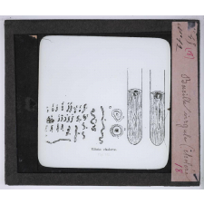 Le Microscope. Ce qu'il permet de voir dans le corps humain. Bacille virgule (choléra).
