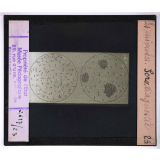 Les Microbes. Séro-diagnostic.