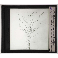Les Plantes saprophytes, mutualistes et parasites. Nodosités dues aux bacilles radicicoles sur les racines des légumineuses.