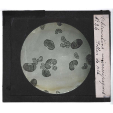 Quelques exemples d'observations microscopiques. Pollen de pin.
