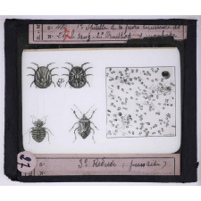 Maladies transmises à l'homme par les animaux. 1° Spirille de la fièvre récurrente dans le sang - 2° Ornithodorus moubata - 3° réduve (punaise).