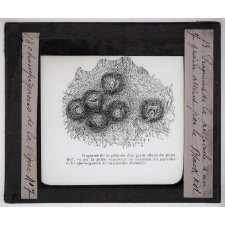 Les Maladies cryptogamiques de la vigne. Fragment de la pellicule d'un grain atteint par le black rot.