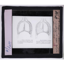 Respiration. Figure schématique montrant une coupe du thorax.