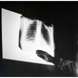 Sanatorium des étudiantes : Vence : Examen d'une radiographie