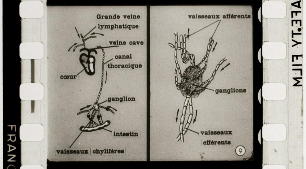 La Tuberculose. Sa. 122.