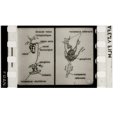 La Tuberculose. Sa. 122.