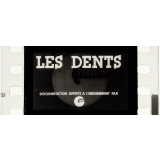 Les Dents.