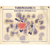 Tuberculose (II). Réaction de l'épiploon. 4e jour.