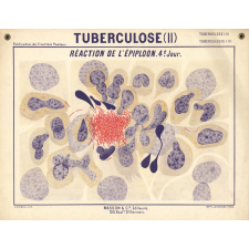 Tuberculose (II). Réaction de l'épiploon. 4e jour.